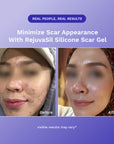 RejûvaSil Silicone Scar Gel 1 oz