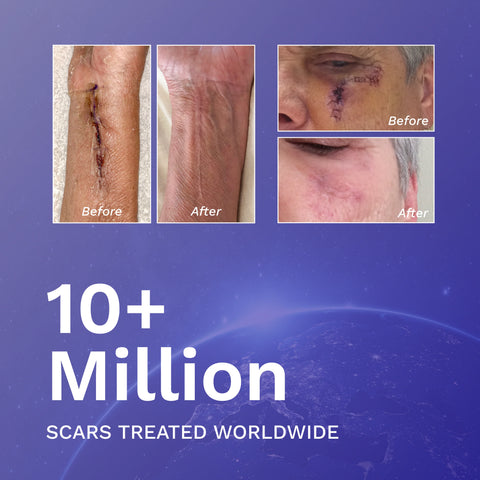 RejûvaSil Silicone Scar Gel 1 oz