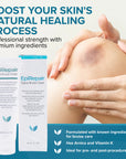 EpiRepair™ Premium Bruise Cream