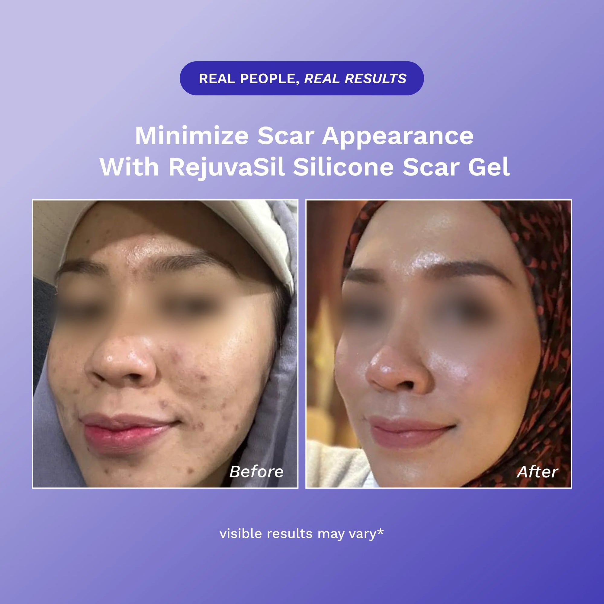 RejûvaSil Silicone Scar Gel 1 oz